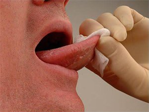 HPV aumenta incidência de câncer de boca e garganta entre jovens