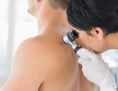 Novo método pode detectar risco de câncer de pele