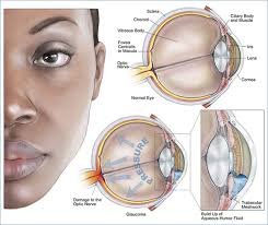 O glaucoma pode provocar a cegueira