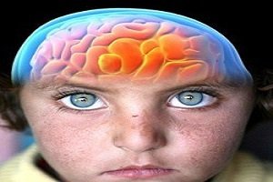 Nova droga mostra eficácia no tratamento de câncer cerebral infantil