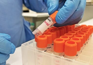 Anvisa: Fiocruz pede registro de kits de diagnóstico de varíola dos macacos
